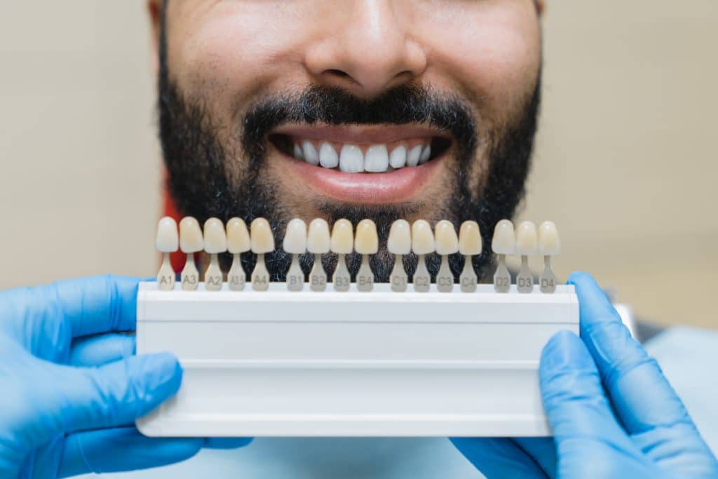 ¿Cómo se ponen las carillas dentales?