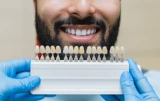 ¿Cómo se ponen las carillas dentales?