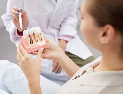 ¿Por qué se aflojan los tornillos de los implantes dentales?