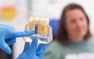 implantes dentales sin hueso