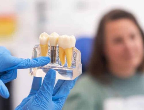 Implantes dentales para pacientes sin hueso