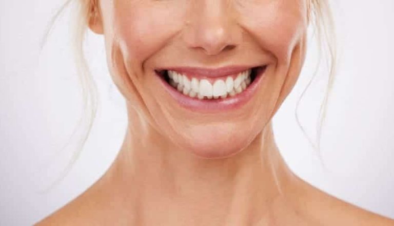 Blanqueamiento-dental-1-1