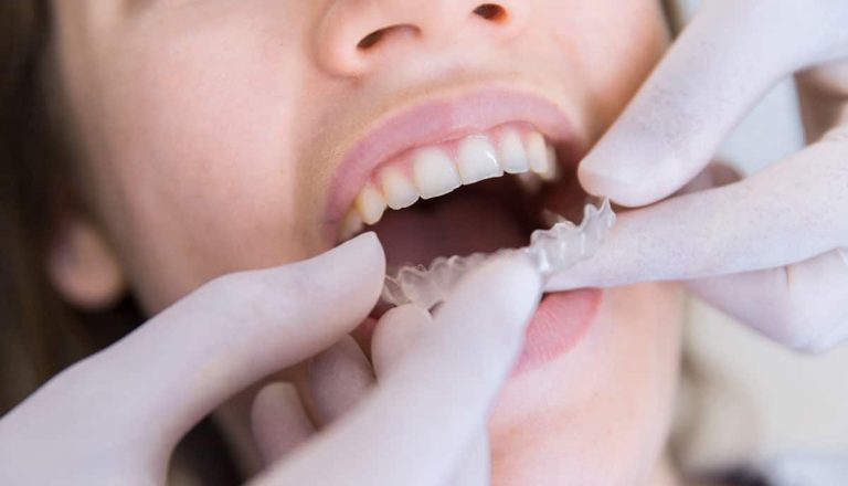 Dentalios_Web_Blog_Post_Ortodoncia_Foto Dentalios_Web_Blog_Post_Ortodoncia_Foto