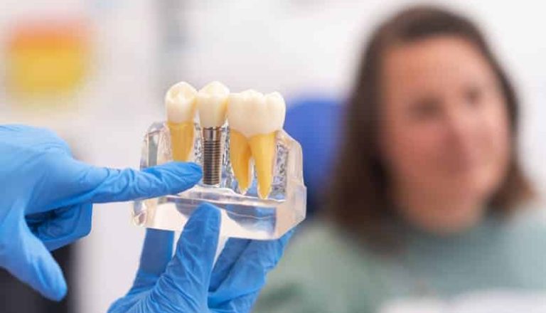 implantes-dentales-para-pacientes-sin-hueso-1-1